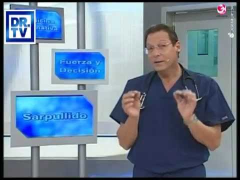 me pica el paladar de arriba alergia