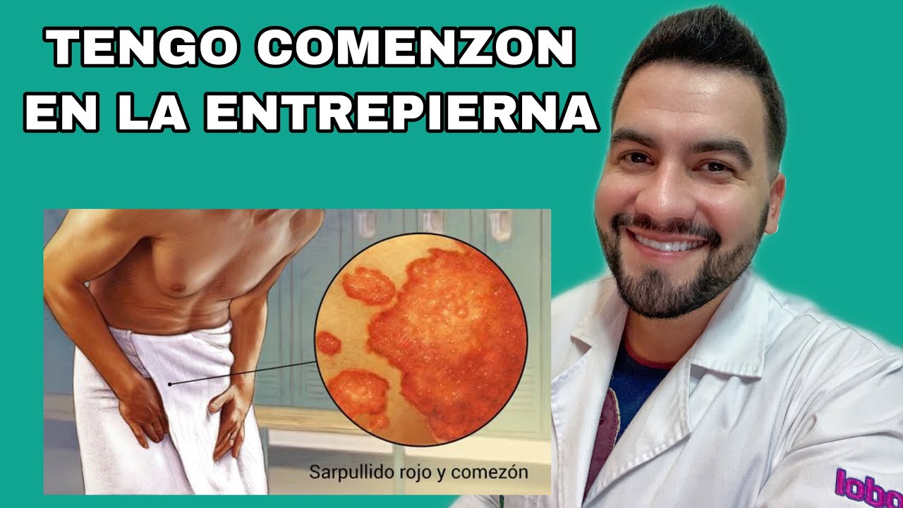 me salieron granitos en la ingle
