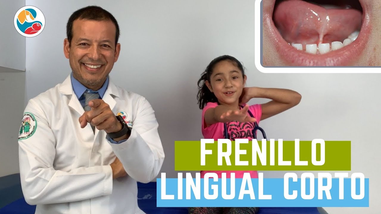operación frenillo lingual niño 6 años