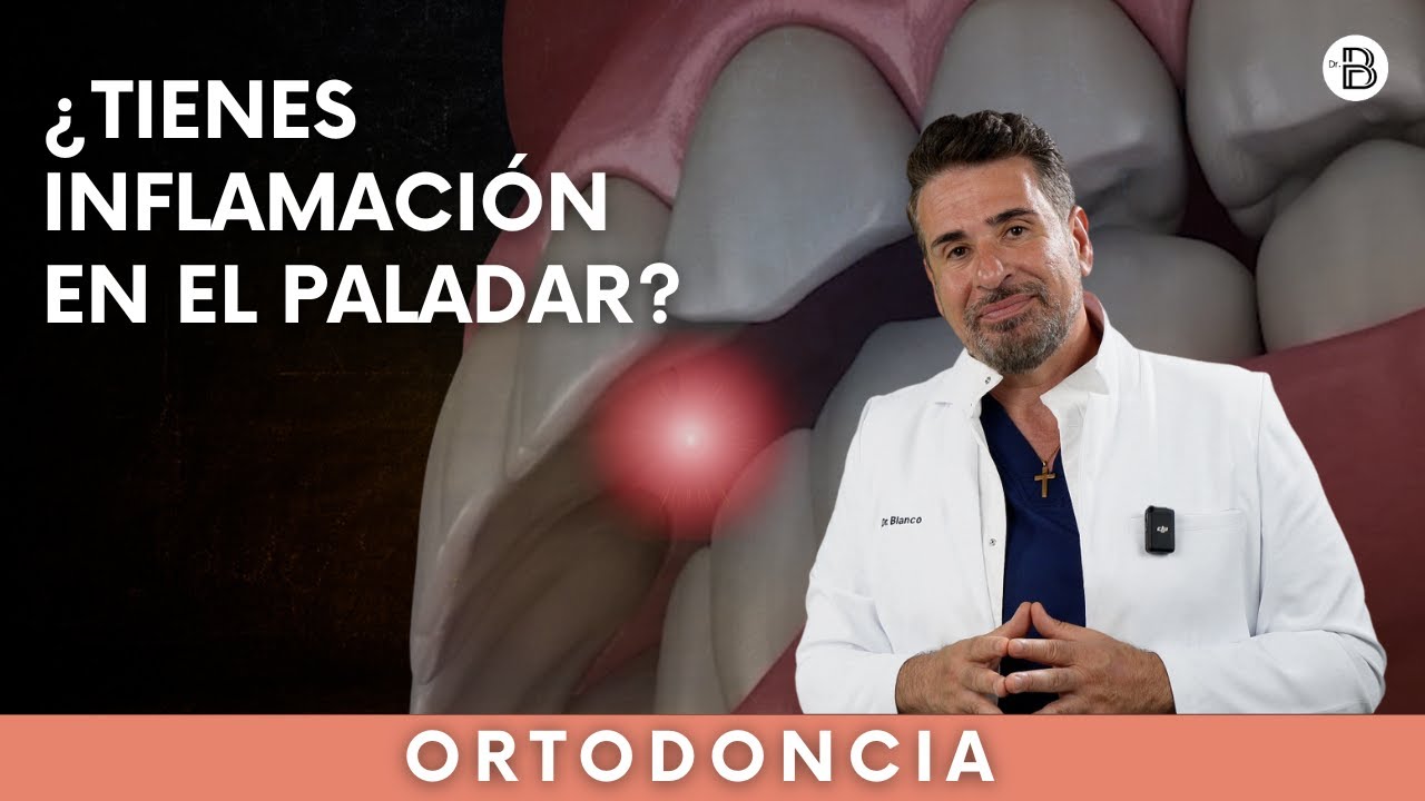 por que se inflama el paladar