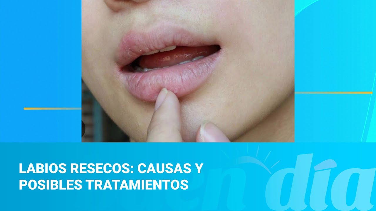 por que se secan los labios
