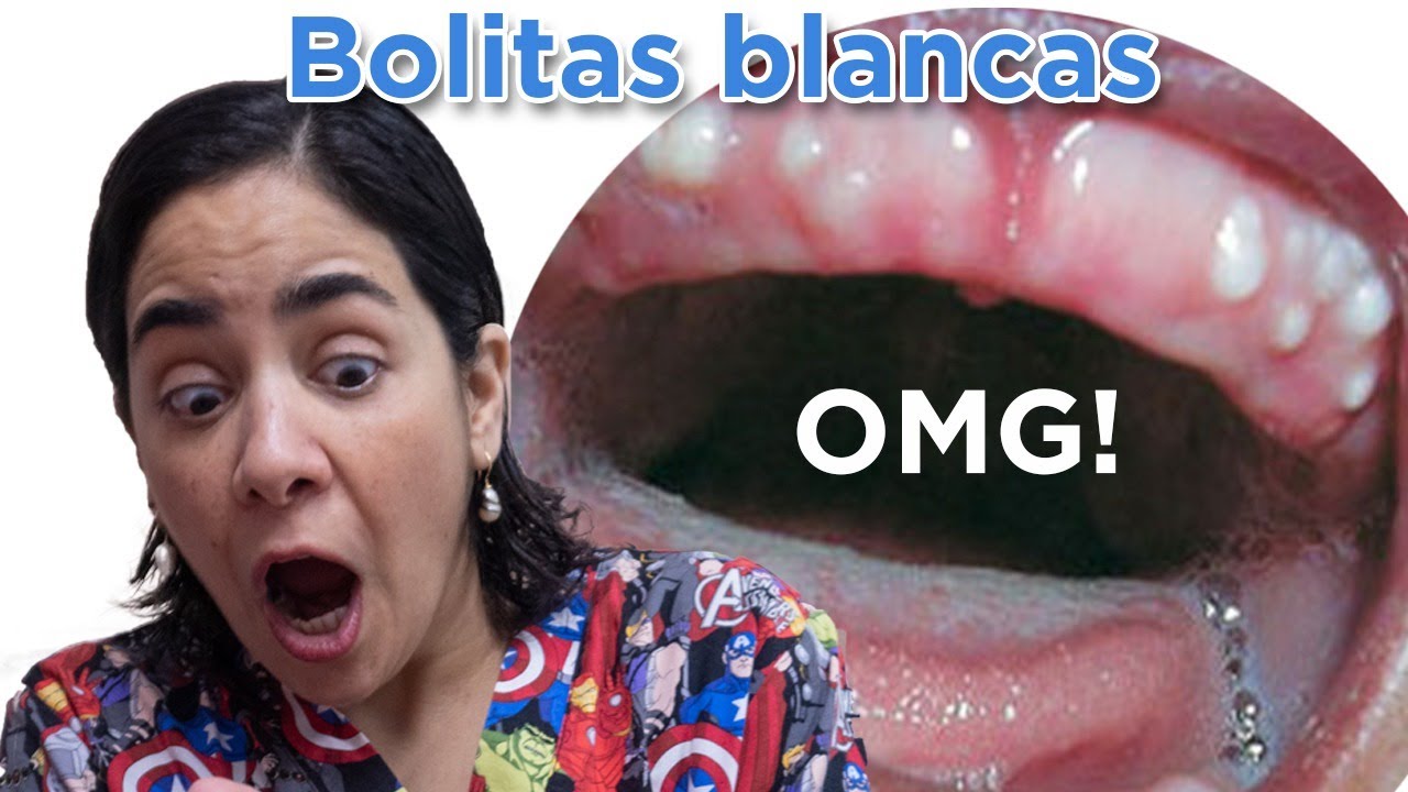 punto blanco en encia de bebe