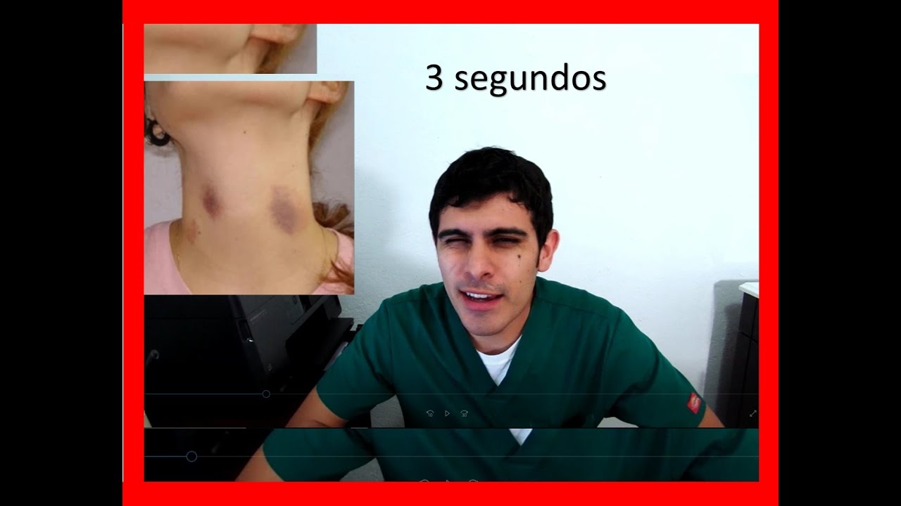 que pasa si te hacen un chupeton