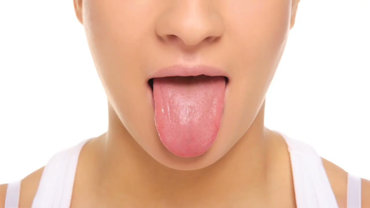 que sirve para desinflamar la lengua