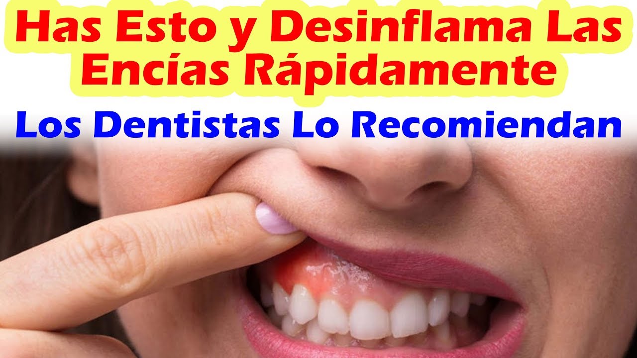 remedios caseros para desinflamar las encías