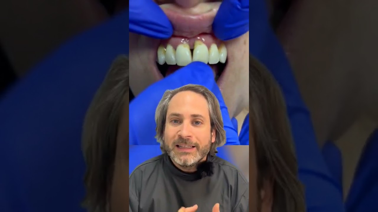 se me mueven los dientes de abajo