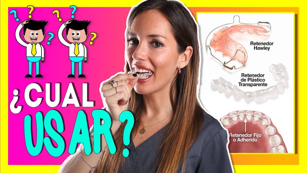 se pueden mover los dientes con retenedores fijos