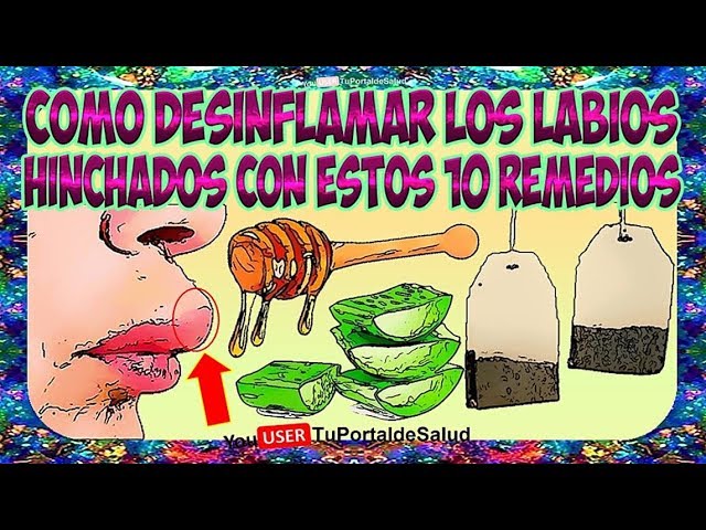 como desinflamar el labio por un golpe