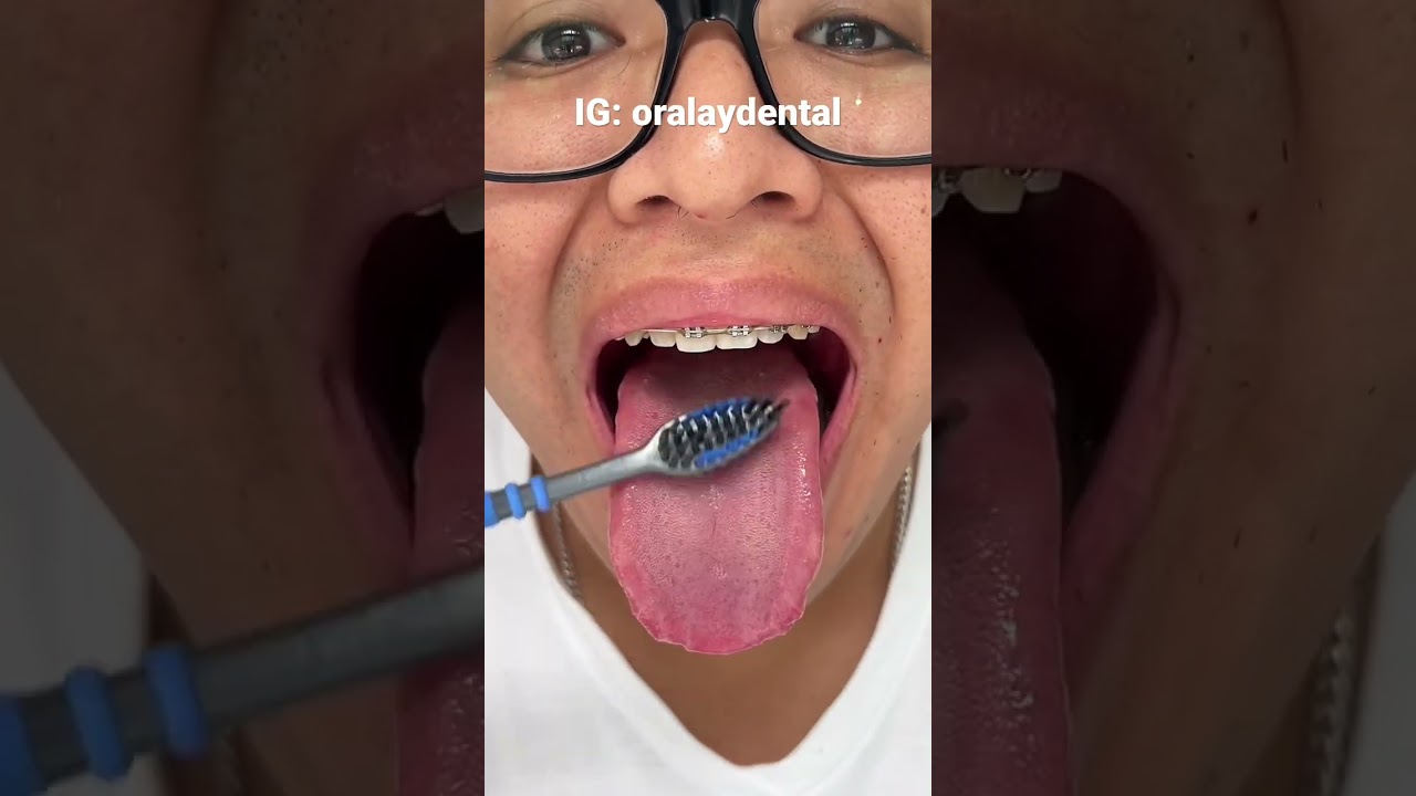 como limpiar la lengua con una cuchara
