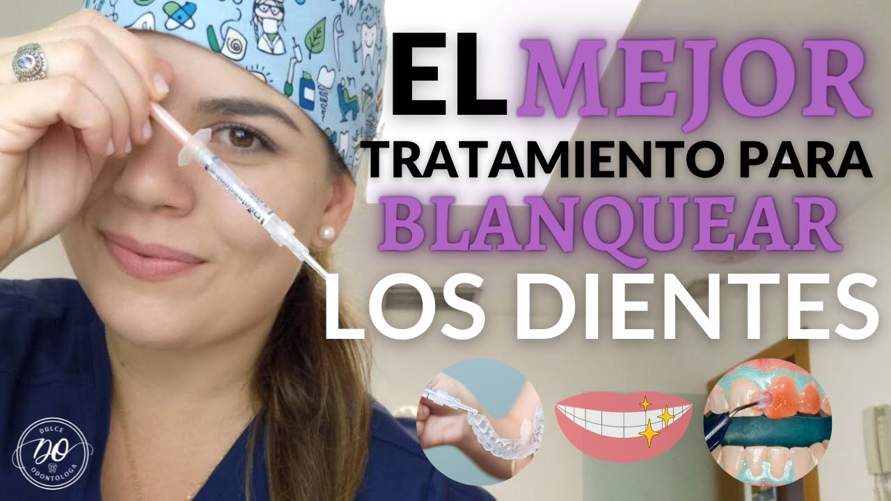 cual es el mejor blanqueador dental
