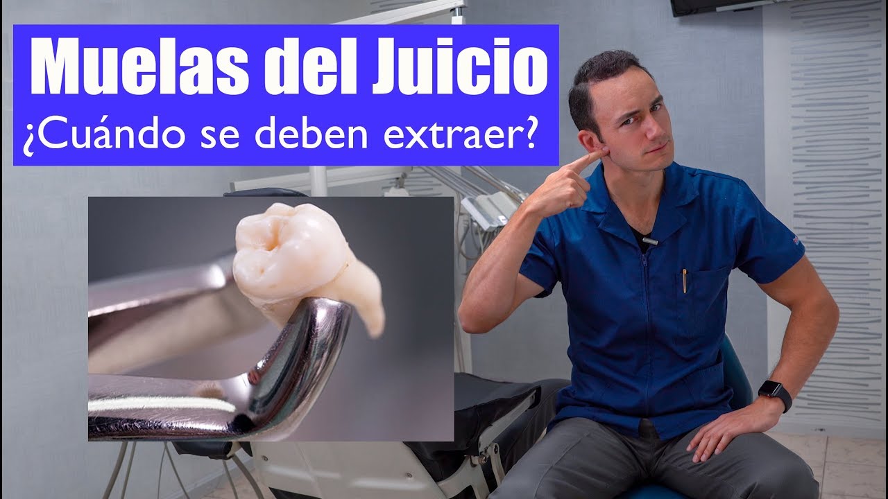 cuando empiezan a salir las muelas del juicio