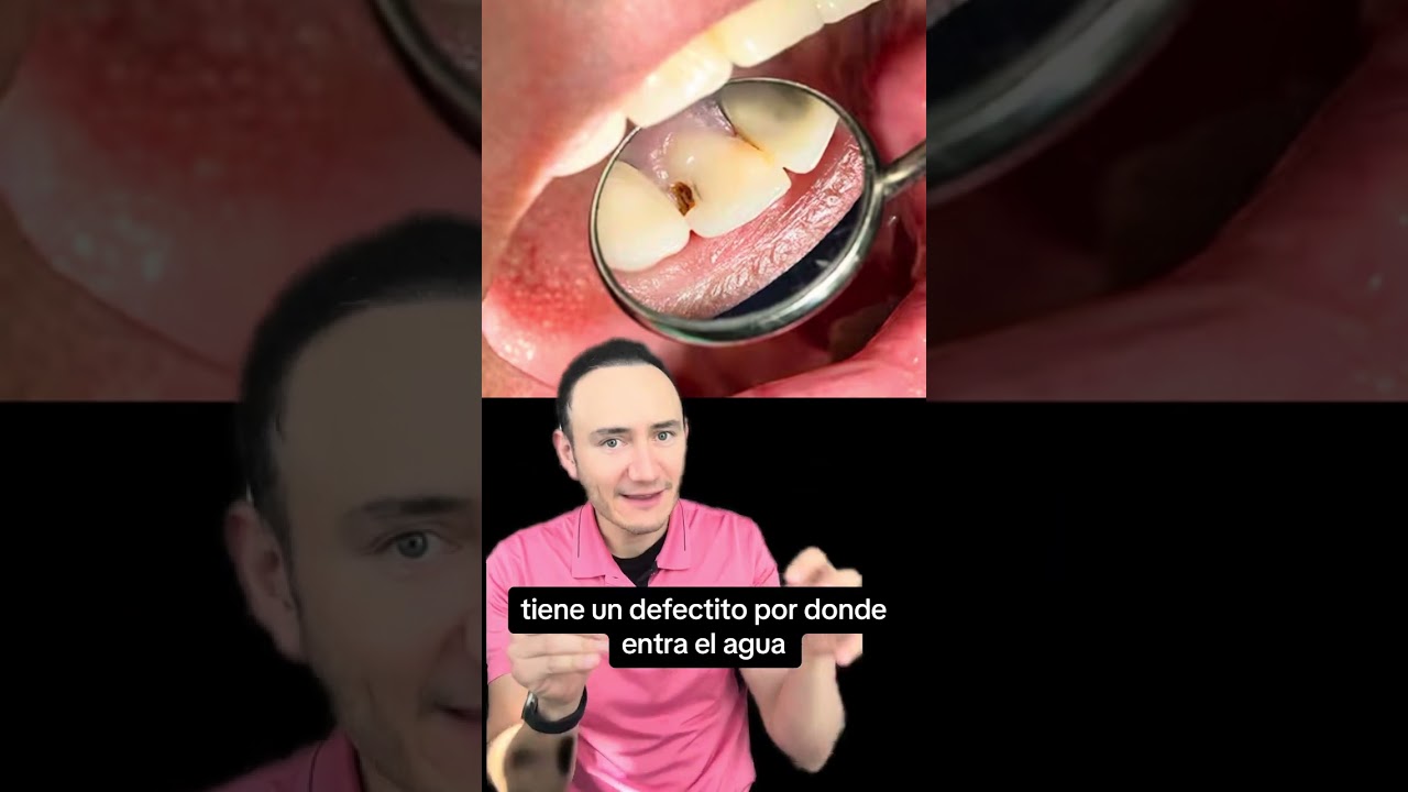 dolor muela al beber agua fría
