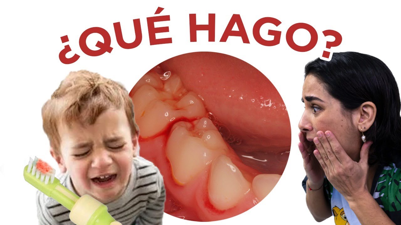 encias inflamadas y sangrantes en niños
