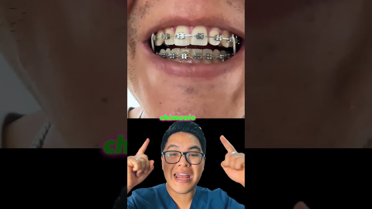 es normal que te duelan los dientes con brackets