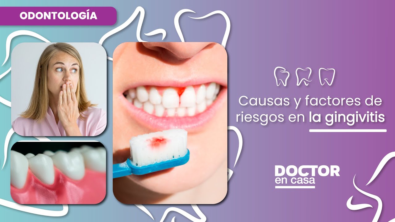 factores de riesgo de la gingivitis