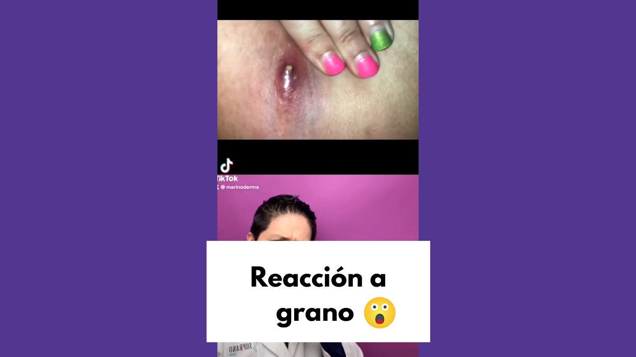 imagenes de granos en la piel