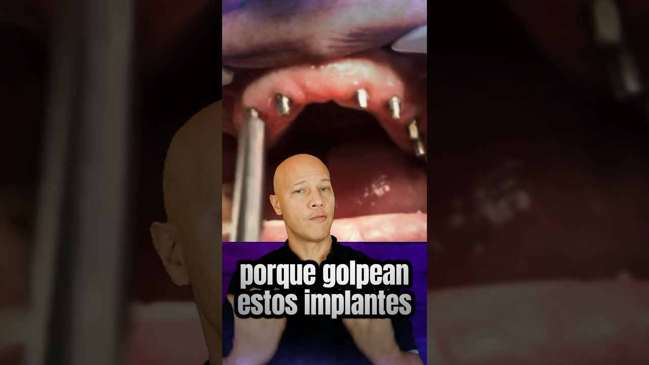 implante dental fuera de la encía
