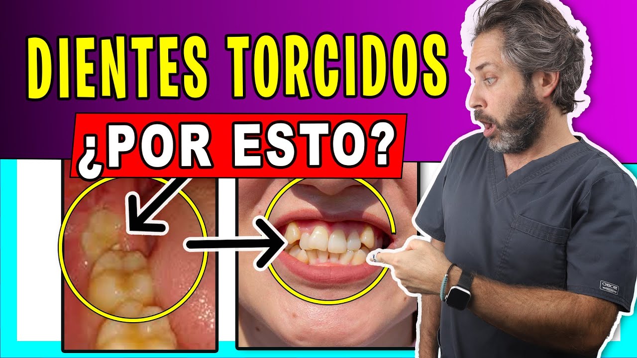 las muelas del juicio mueven los dientes