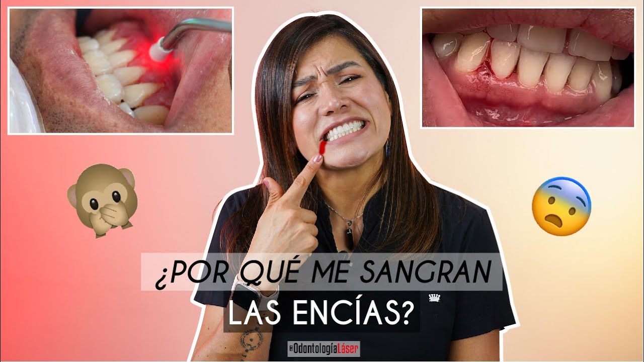 me sangran las encias de la nada