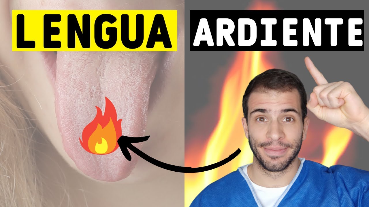 por qué me pica la lengua