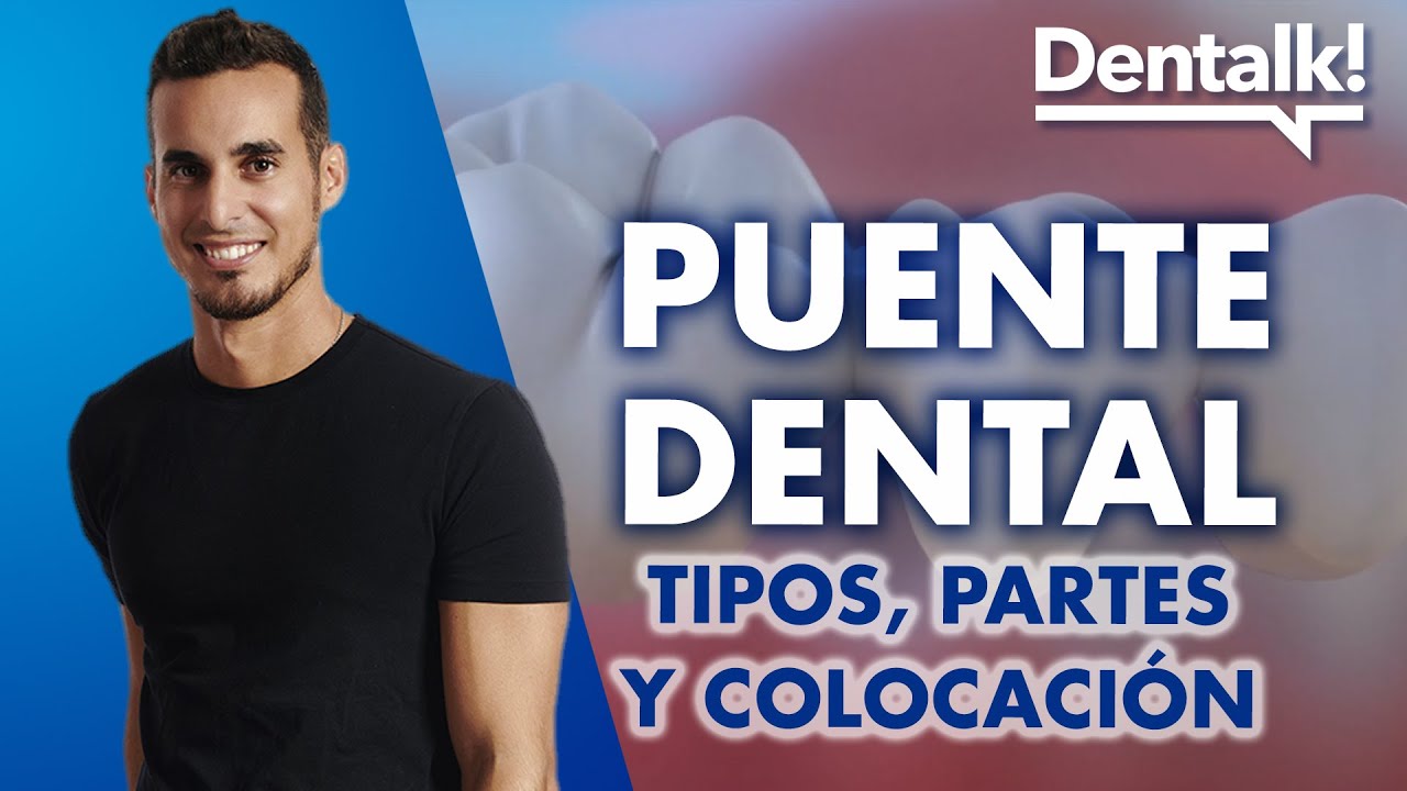puente dental de 10 piezas precio
