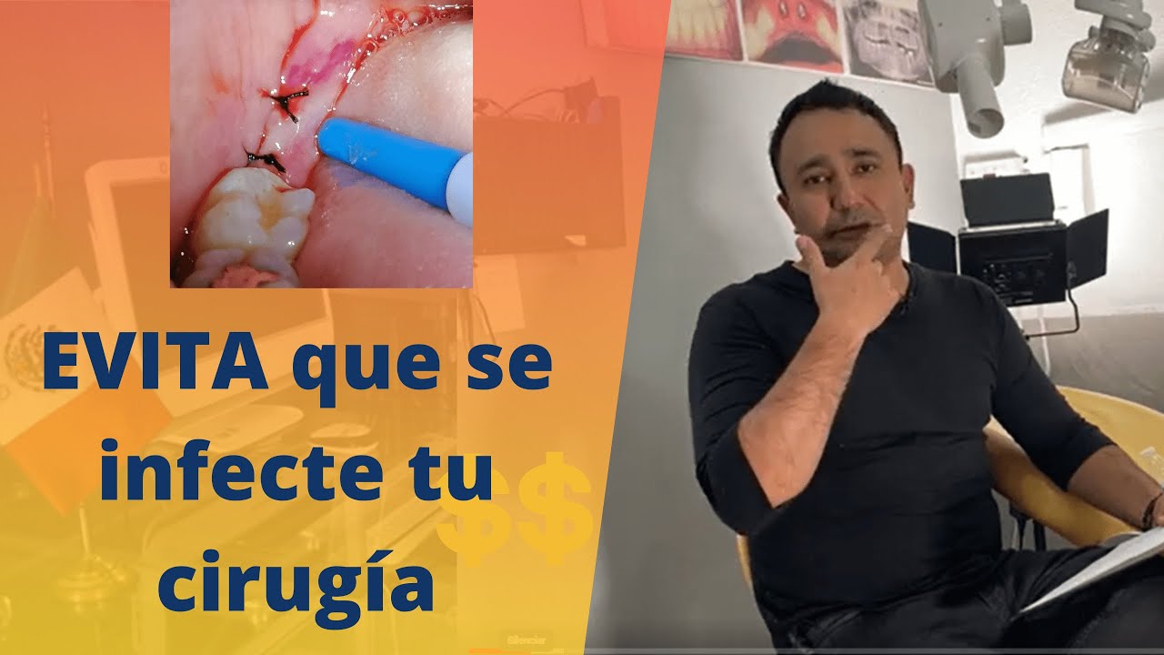 que comer con puntos en la boca