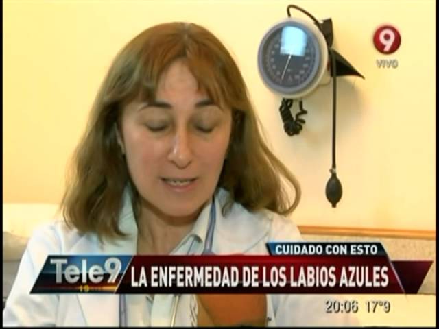 que enfermedad te pone los labios morados
