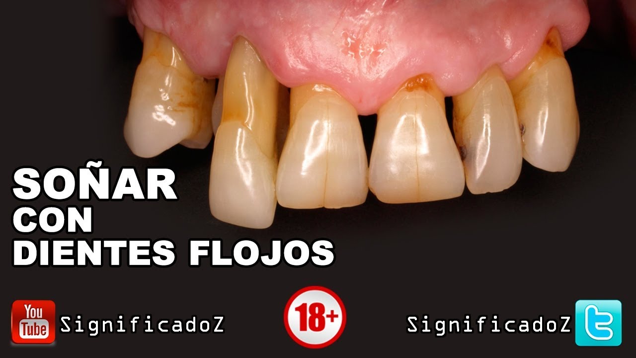 que significa soñar con los dientes flojos