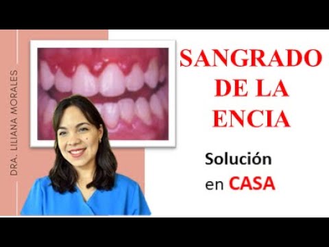 remedios caseros para el sangrado de encías