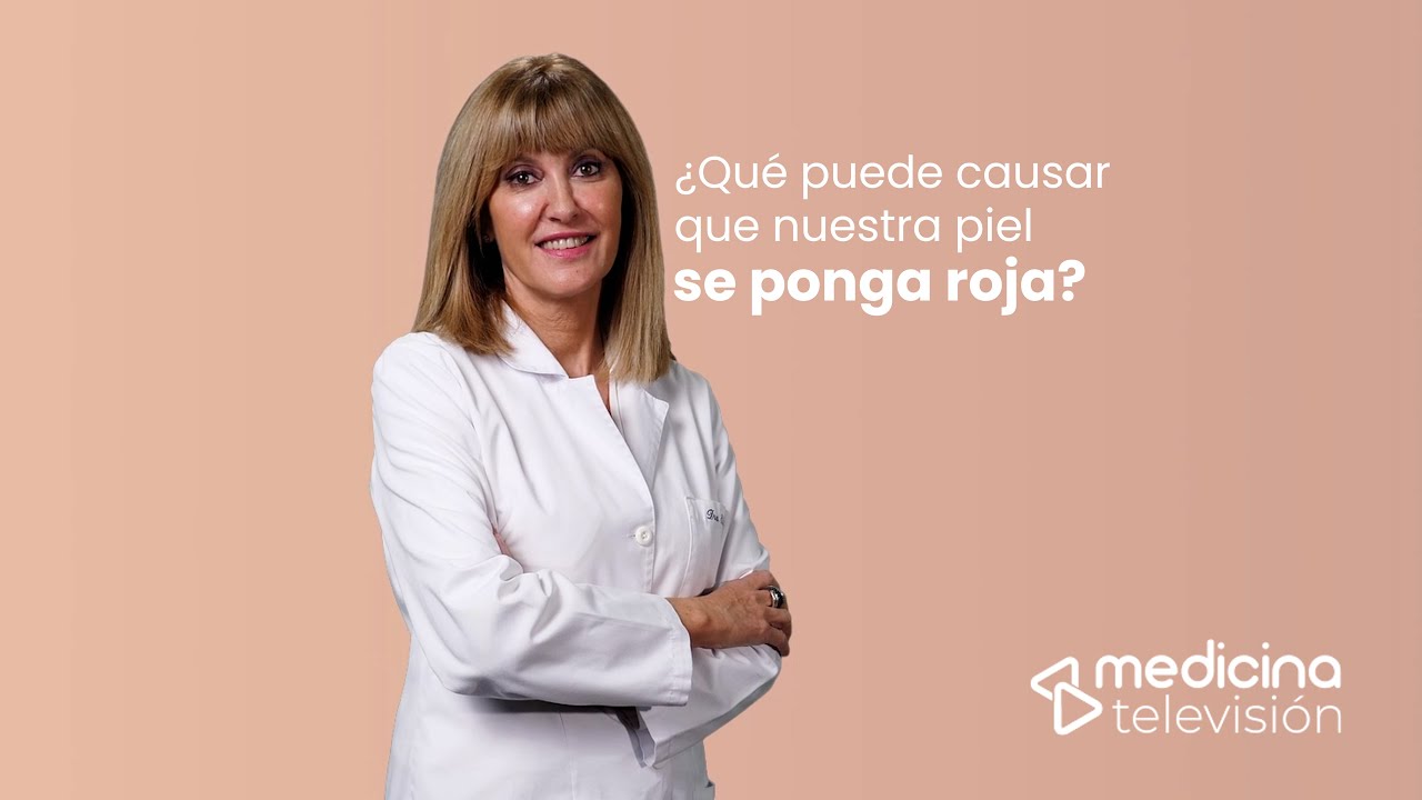 se me pone la cara roja de repente