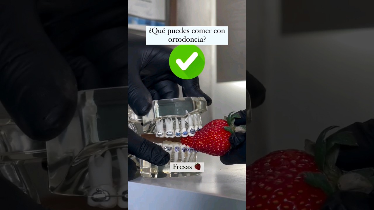 se puede comer con las gomas de ortodoncia
