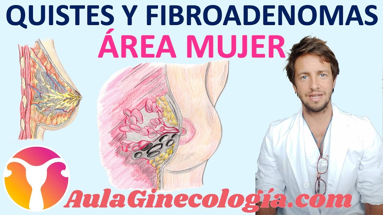 bolita en el seno con implantes