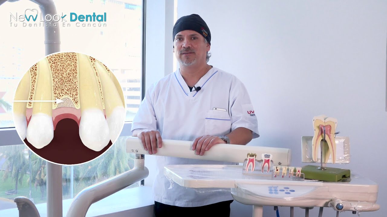 brackets en adultos antes y despues