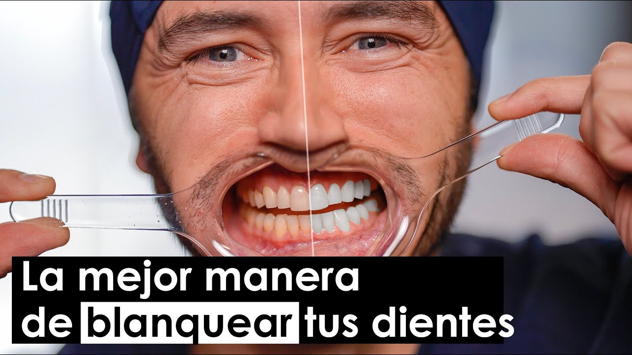 como blanquear los dientes sin dañarlos
