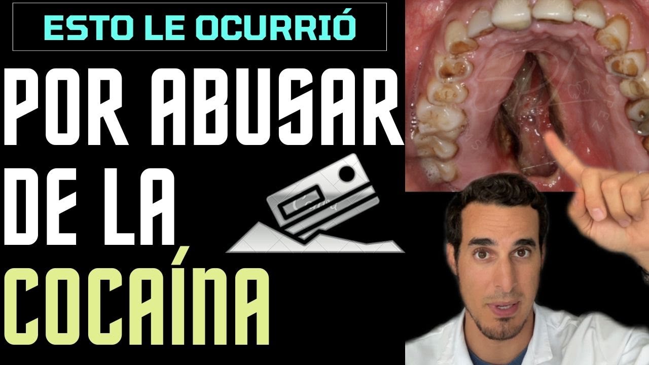 como curar agujero en el paladar
