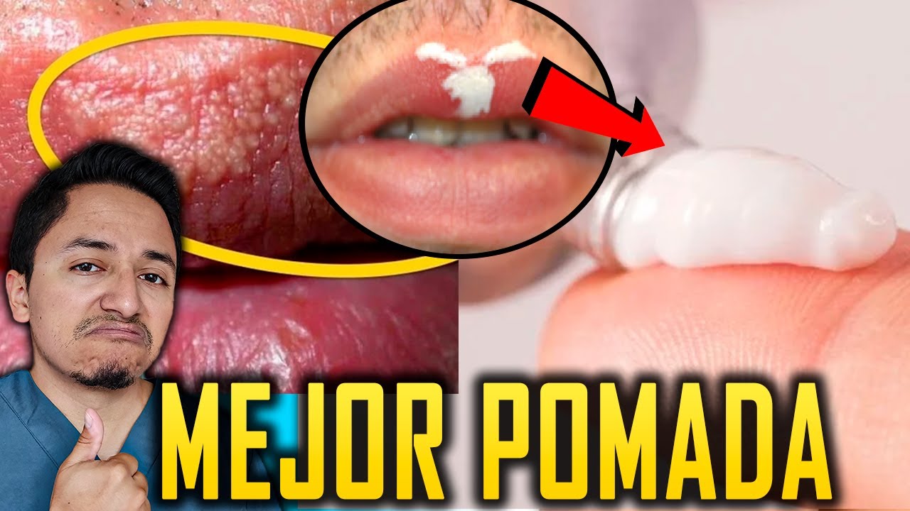 como quitar granitos en la boca