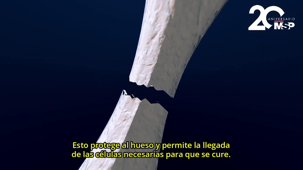cuanto tarda un hueso en soldar