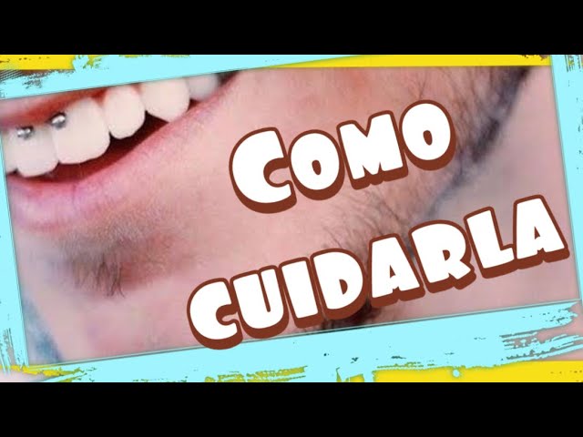cuidados de la perforacion del frenillo