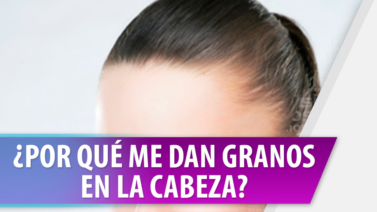 granos en la cabeza que duelen