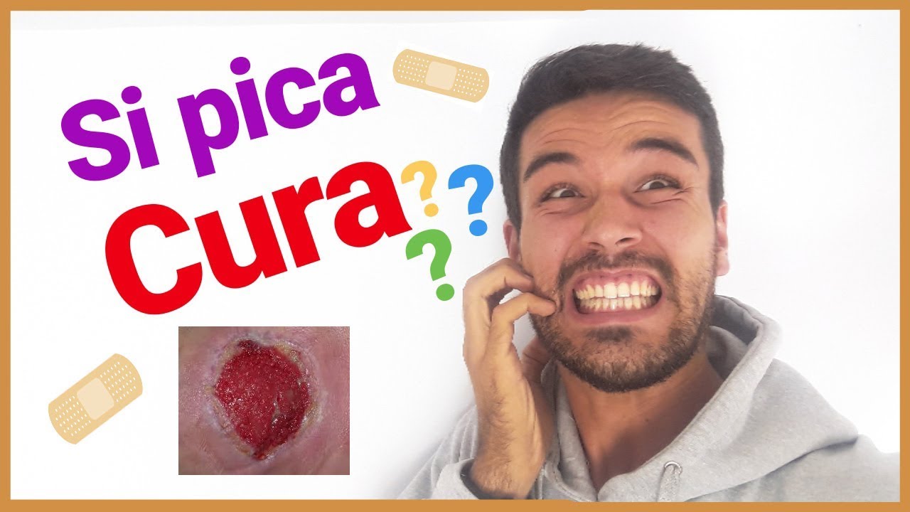 me pica el piercing cuando lo curo