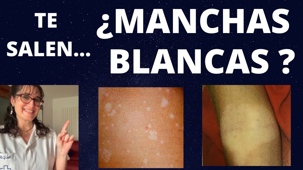 por que salen puntitos blancos en la piel