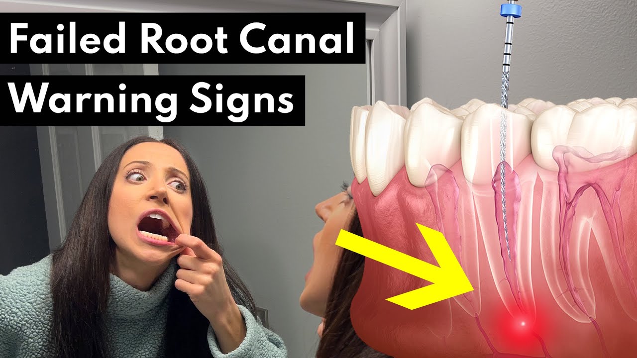 pressure pain on root canal tooth