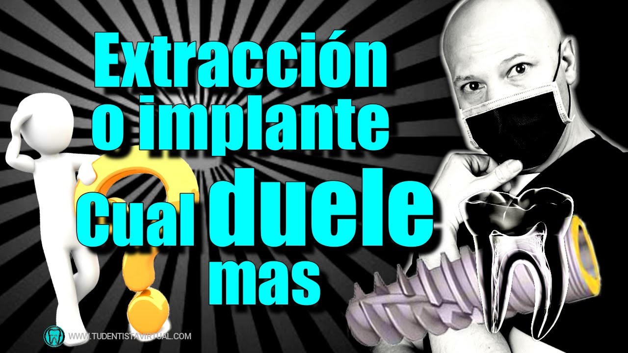 que duele más un implante o una extracción