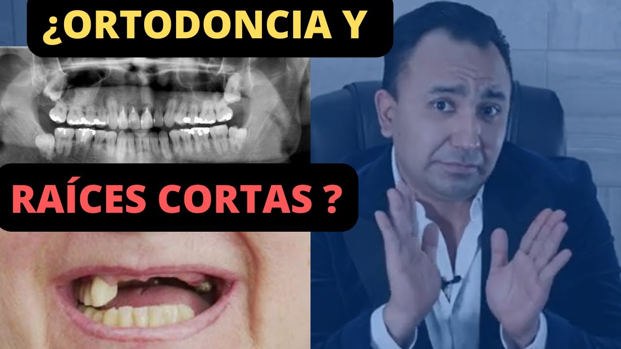 que tejido recubre la raiz de nuestros dientes