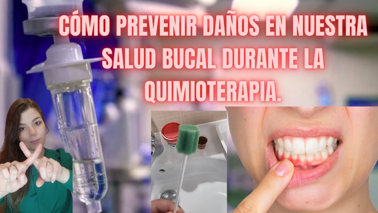 se puede ir al dentista recibiendo quimioterapia