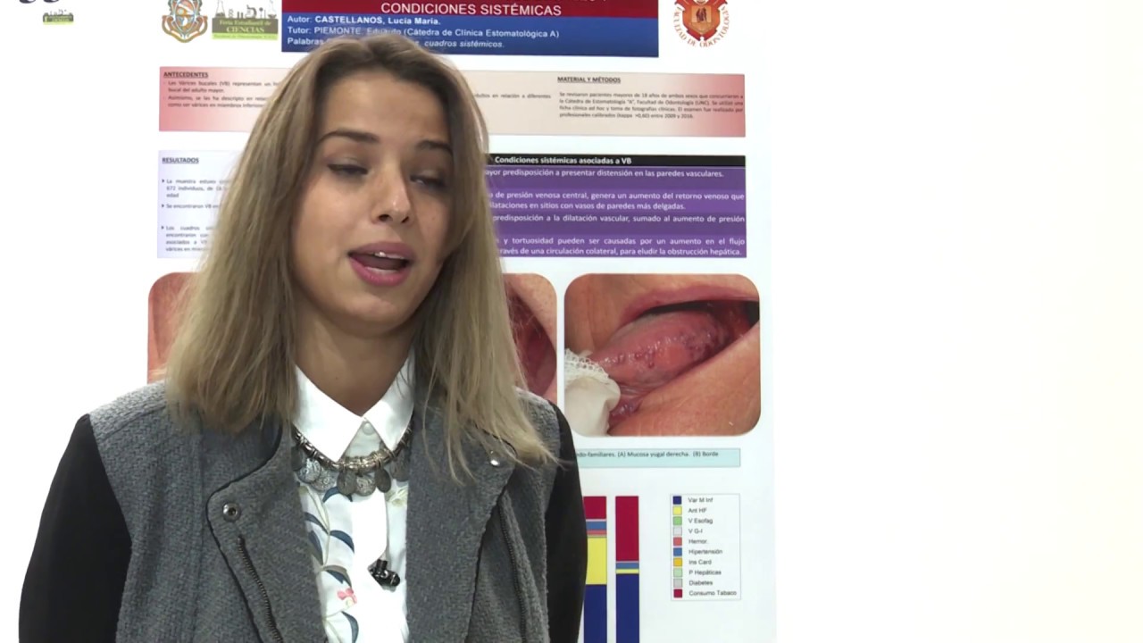 son peligrosas las varices en la lengua