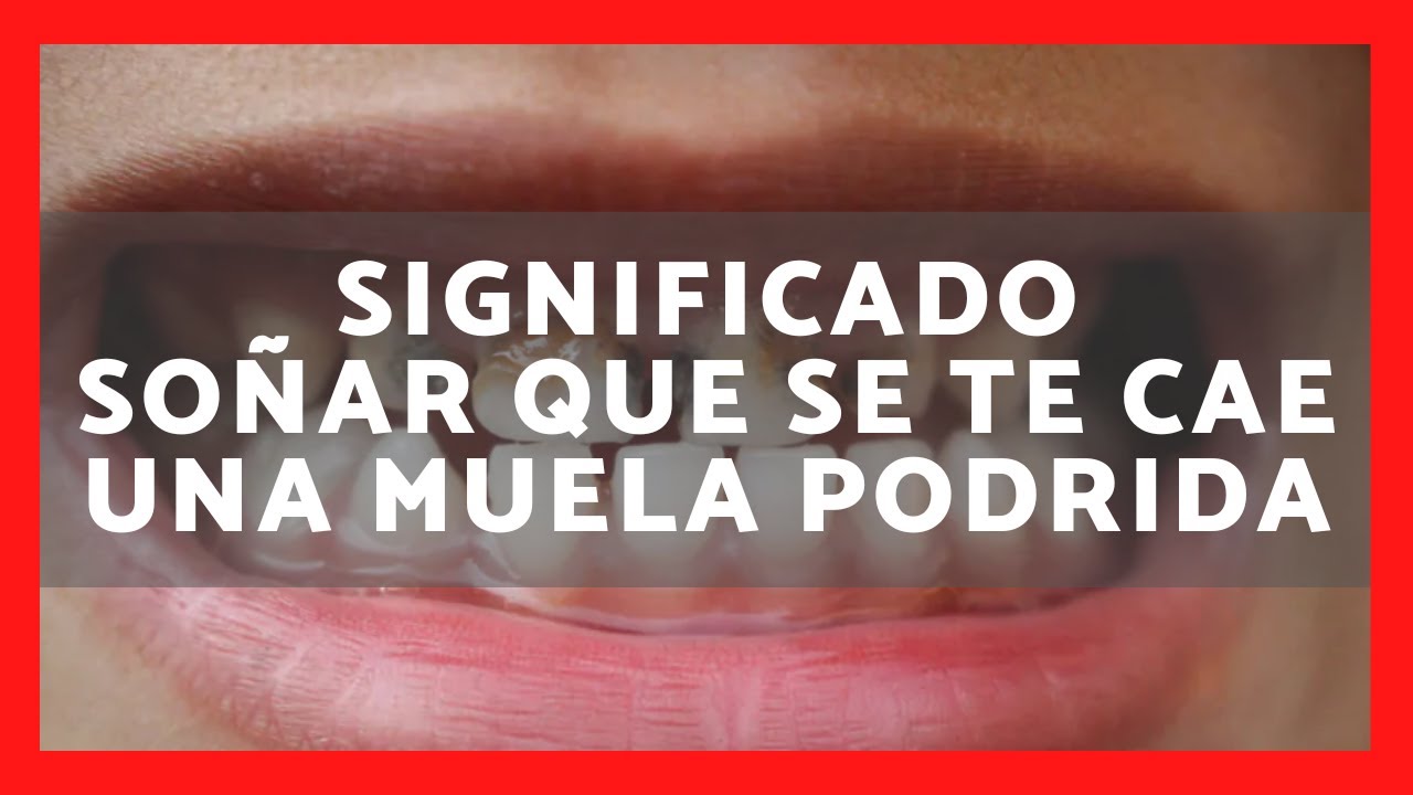 soñar que se te cae una muela podrida