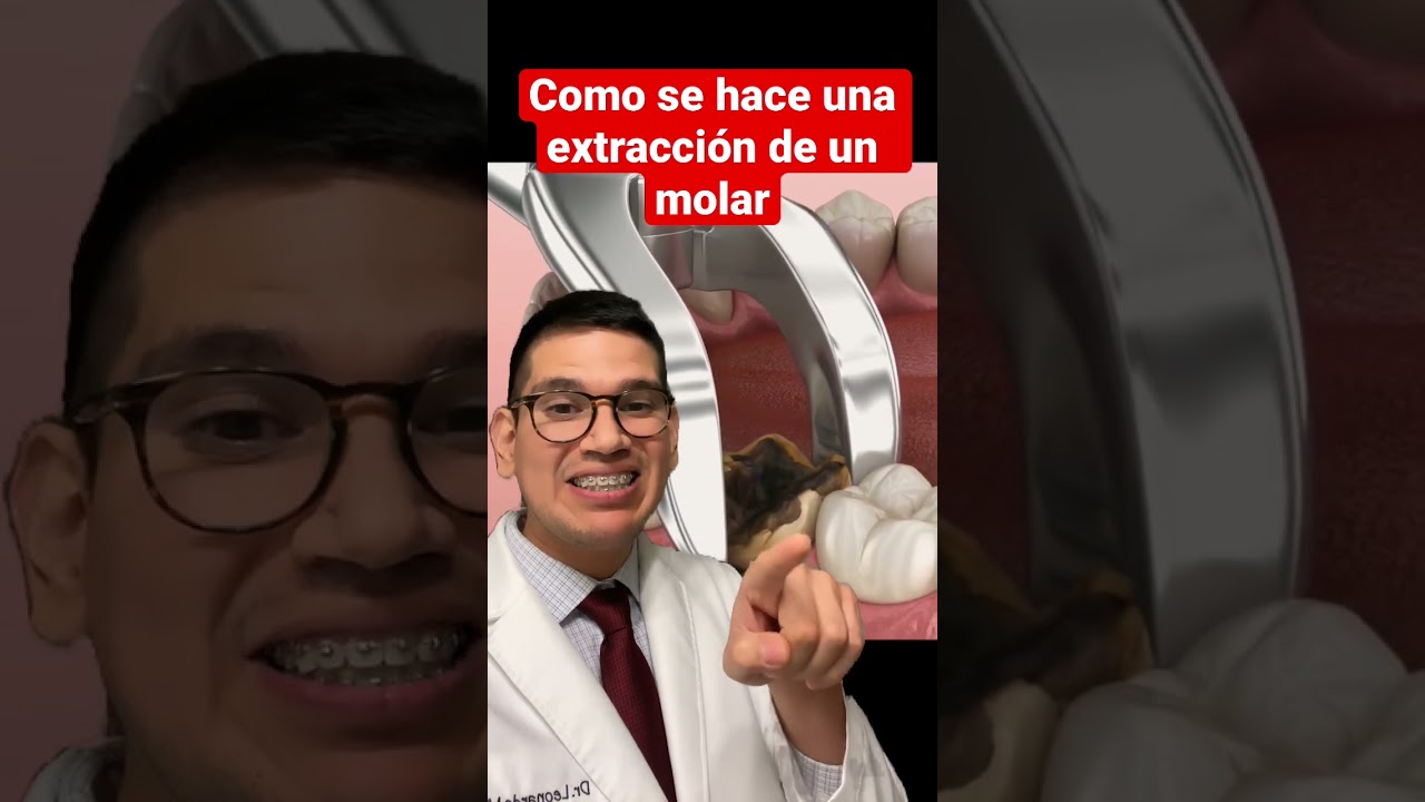 trucos para fumar después extracción muela foro