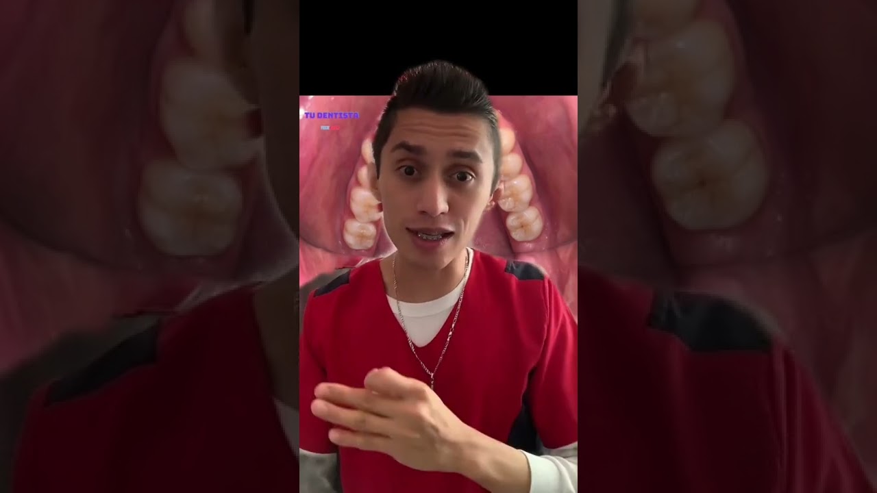 como saber si tengo una caries