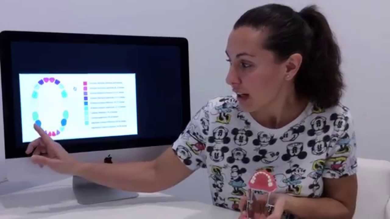 cuantos dientes de leche tiene un niño